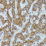 ApoC3 Antibody in Immunohistochemistry (Paraffin) (IHC (P))