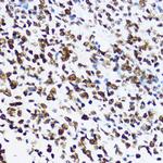 H4K12ac Antibody in Immunohistochemistry (Paraffin) (IHC (P))