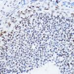 H4K12ac Antibody in Immunohistochemistry (Paraffin) (IHC (P))