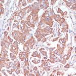 LRP1 Antibody in Immunohistochemistry (Paraffin) (IHC (P))