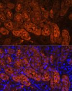 MIOX Antibody in Immunohistochemistry (Paraffin) (IHC (P))