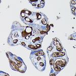 Fibrinogen alpha chain Antibody in Immunohistochemistry (Paraffin) (IHC (P))