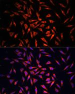 GSDMC Antibody in Immunocytochemistry (ICC/IF)