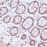 S100A5 Antibody in Immunohistochemistry (Paraffin) (IHC (P))