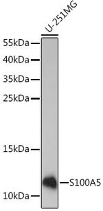 S100A5 Antibody in Western Blot (WB)