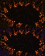 OXCT2 Antibody in Immunohistochemistry (Paraffin) (IHC (P))