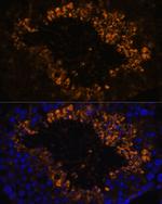 OXCT2 Antibody in Immunohistochemistry (Paraffin) (IHC (P))