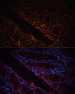 A33 Antibody in Immunohistochemistry (Paraffin) (IHC (P))