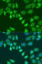 L2HGDH Antibody in Immunocytochemistry (ICC/IF)