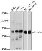 TSEN54 Antibody in Western Blot (WB)