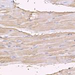 Myosin 4 Antibody in Immunohistochemistry (Paraffin) (IHC (P))