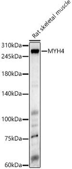 Myosin 4 Antibody in Western Blot (WB)