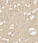 Calmodulin Antibody in Immunohistochemistry (Paraffin) (IHC (P))