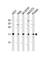 Calmodulin Antibody in Western Blot (WB)