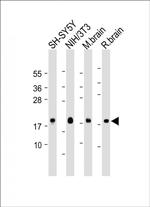 Calmodulin Antibody in Western Blot (WB)