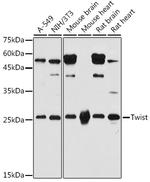 TWIST1 Antibody in Western Blot (WB)