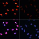 H2BK5ac Antibody in Immunocytochemistry (ICC/IF)