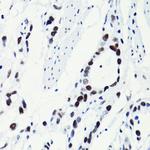 H2BK5ac Antibody in Immunohistochemistry (Paraffin) (IHC (P))