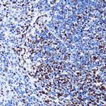 H2BK5ac Antibody in Immunohistochemistry (Paraffin) (IHC (P))