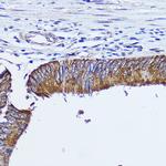 RhoA Antibody in Immunohistochemistry (Paraffin) (IHC (P))