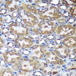 ACTR1B Antibody in Immunohistochemistry (Paraffin) (IHC (P))