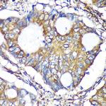 ACTR1B Antibody in Immunohistochemistry (Paraffin) (IHC (P))