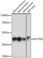 ACTR1B Antibody in Western Blot (WB)