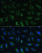 RAPGEF1 Antibody in Immunocytochemistry (ICC/IF)