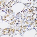 USP33 Antibody in Immunohistochemistry (Paraffin) (IHC (P))