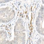 NALP1 Antibody in Immunohistochemistry (Paraffin) (IHC (P))