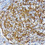 CK1 alpha Antibody in Immunohistochemistry (Paraffin) (IHC (P))