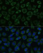 DDX6 Antibody in Immunocytochemistry (ICC/IF)