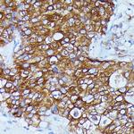 DDX6 Antibody in Immunohistochemistry (Paraffin) (IHC (P))