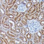 DDX6 Antibody in Immunohistochemistry (Paraffin) (IHC (P))