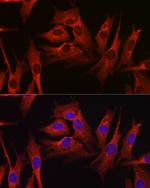 HMGCR Antibody in Immunocytochemistry (ICC/IF)