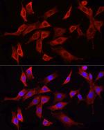 HMGCR Antibody in Immunocytochemistry (ICC/IF)