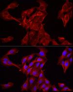 HMGCR Antibody in Immunocytochemistry (ICC/IF)