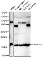 ATP6V0C Antibody in Western Blot (WB)