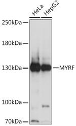 C11orf9 Antibody in Western Blot (WB)