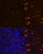 KAL1 Antibody in Immunohistochemistry (Paraffin) (IHC (P))