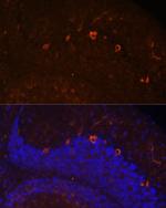 KAL1 Antibody in Immunohistochemistry (Paraffin) (IHC (P))