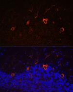 KAL1 Antibody in Immunohistochemistry (Paraffin) (IHC (P))