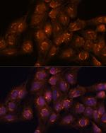 ACBD3 Antibody in Immunocytochemistry (ICC/IF)