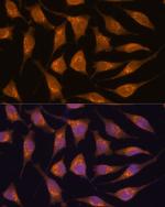 ACBD3 Antibody in Immunocytochemistry (ICC/IF)