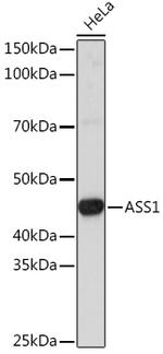 ASS1 Antibody in Western Blot (WB)