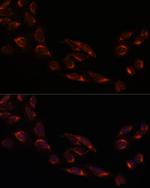 NSDHL Antibody in Immunocytochemistry (ICC/IF)