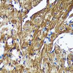 NSDHL Antibody in Immunohistochemistry (Paraffin) (IHC (P))