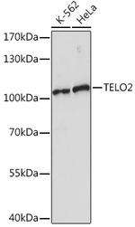 TELO2 Antibody in Western Blot (WB)