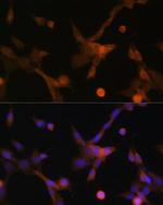 PUMA alpha Antibody in Immunocytochemistry (ICC/IF)