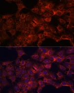 PDP2 Antibody in Immunocytochemistry (ICC/IF)